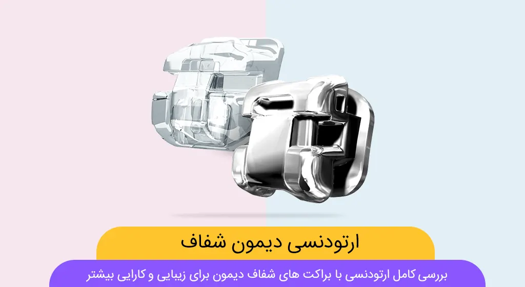 ارتودنسی دیمون شفاف شاخص