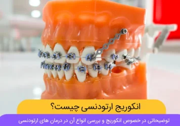 انکوریج ارتودنسی شاخص