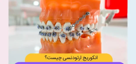 انکوریج ارتودنسی شاخص