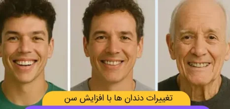تغییرات دندان ها با افزایش سن شاخص