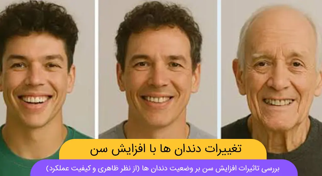 تغییرات دندان ها با افزایش سن شاخص