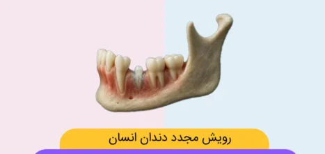رویش مجدد دندان انسان شاخص