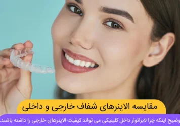الاینر خارجی یا داخلی شاخص