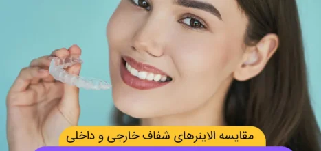 الاینر خارجی یا داخلی شاخص