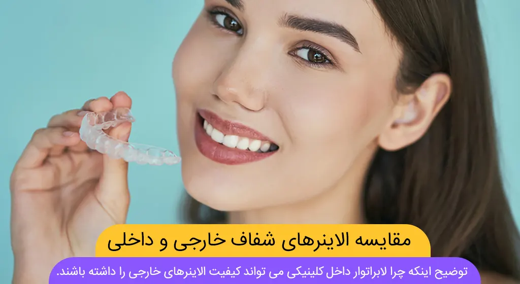 الاینر خارجی یا داخلی شاخص