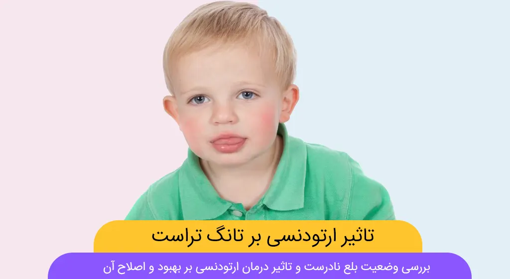تانگ تراست شاخص