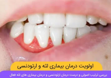 ارتودنسی همزمان با درمان لثه شاخص