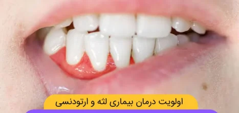 ارتودنسی همزمان با درمان لثه شاخص