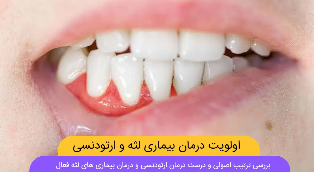 ارتودنسی همزمان با درمان لثه شاخص