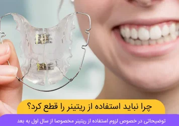 چرا نباید استفاده از ریتینر را قطع کرد شاخص