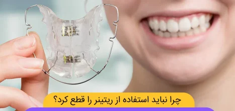 چرا نباید استفاده از ریتینر را قطع کرد شاخص