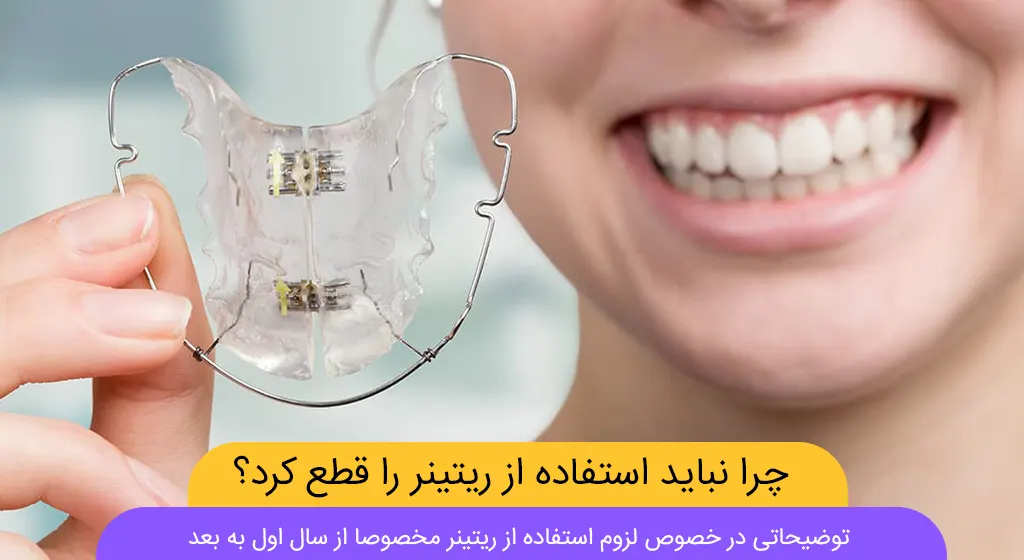 چرا نباید استفاده از ریتینر را قطع کرد شاخص