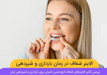 تاثیر ارتودنسی نامرئی با الاینرهای شفاف روی بارداری و شیردهی