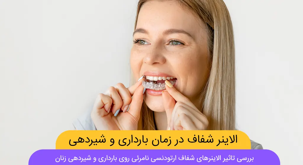 تاثیر ارتودنسی نامرئی با الاینرهای شفاف روی بارداری و شیردهی