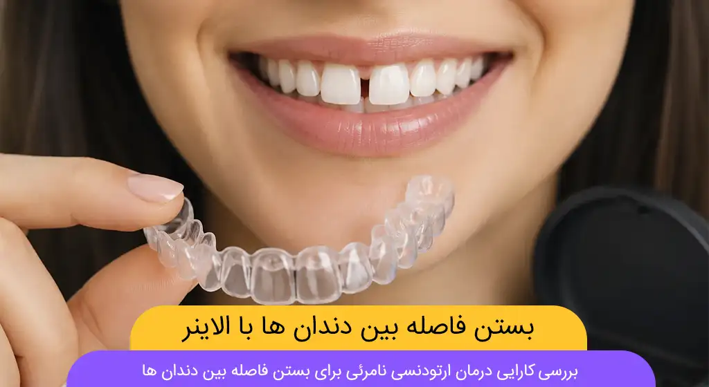 آیا ارتودنسی نامرئی برای بستن فاصله بین دندان ها شاخص