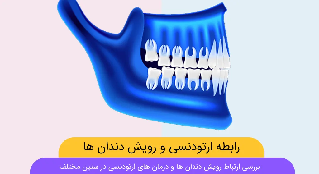 رابطه ارتودنسی و رویش دندان ها شاخص