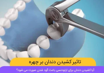 آیا کشیدن دندان برای ارتودنسی باعث گود شدن صورت می شود؟ شاخص