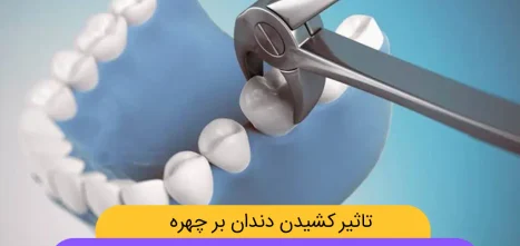 آیا کشیدن دندان برای ارتودنسی باعث گود شدن صورت می شود؟ شاخص