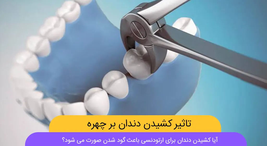 آیا کشیدن دندان برای ارتودنسی باعث گود شدن صورت می شود؟ شاخص