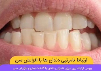 ارتباط نامرتبی دندان ها با افزایش شن شاخص