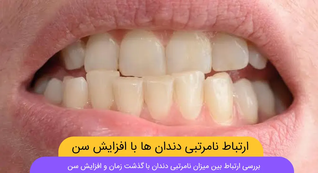 ارتباط نامرتبی دندان ها با افزایش شن شاخص