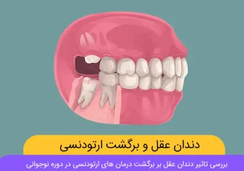 تاثیر دندان عقل بر برگشت ارتودنسی شاخص